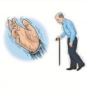 帕金森是什么原因引起的